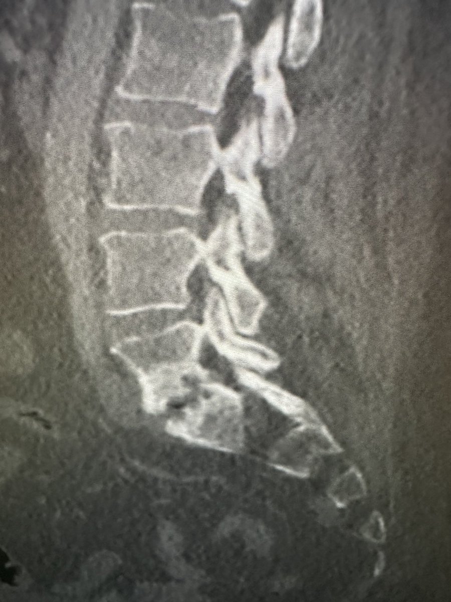 RJ on Twitter "Disc space looked Nl by CT year ago. Now w erosions