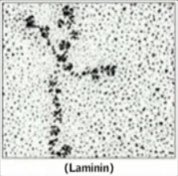 Science is not in conflict with the existence of God, science proves God’s existence. This is Laminin. Laminin is a protein in the membrane of the adult skeletal muscle. Scientists discovered that it literally holds human beings together. Do you notice it’s shape? It’s a cross!…