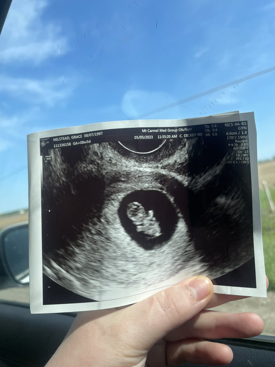 graasss_'s tweet photo. we have prayed for you, sweet little one ♥️♥️ https://t.co/6eI6gfPadP