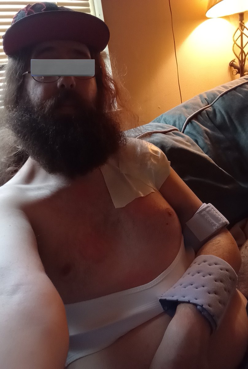 Terryble_Person's tweet photo. Welp day 2 has sucked ass.
12 weeks in this sling at least.

No more pics for awhile.
My entire left arm and pec is black and bruised.

Completely 100% labrum torn off the bone and anchors from old surgery.

100% torn bicep.
Shit sucks https://t.co/szd8704Gy2