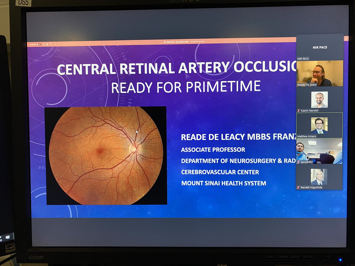 Thank you @rdeleacymd for the intriguing discussion on endovascular therapy for central retinal artery occlusion! @EricRSmithMD @RaghavMattay @DrKazNIR @MattAmansMD @DowdCf