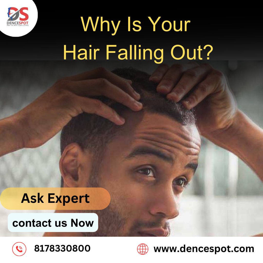DenceSpot's tweet photo. Why Is Your Hair Falling Out Consult With Our Hair Experts Get 10-20% Discount On Rs 49,000 Package More Information Contact Us : 8178330800
visit : https://t.co/nyTffjDS6d
#dencespot #haircare #Hairlosstreatment #HairTransplant #FUE #HairRoots #HairGrowing #HairJourney https://t.co/gNbWifZ35A