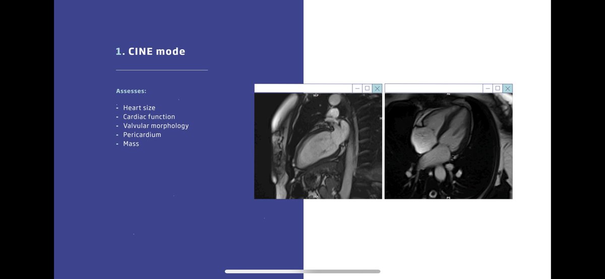 bennybristol's tweet photo. Fantastic patient information video from @escardio on #whyCMR Includes visualisation of the examination for apprehensive patients as well as clinical and safety details for the more inquisitive ones. Congrats to the whole team @Sarah_Moharem @s_e_petersen @Cosyns 🧲💜#EACVI2023 https://t.co/b4sEl71dS3