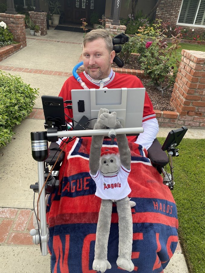 skalpakoff's tweet image. #ALS is a progressive neurodegenerative disease that affects nerve cells in the brain and spinal cord. It causes muscle weakness and wasting, and eventually leads to death. There is no cure for ALS, but there are treatments that can help slow the progression of the disease.

May…