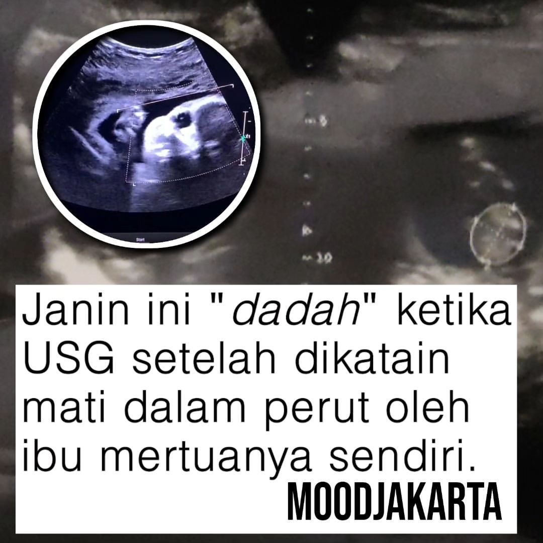 recehtapisayng's tweet photo. Dedeknya pengertian banget ❤️

[📸 Twitter/Tanyakanrl] https://t.co/iB0d9yUbnZ