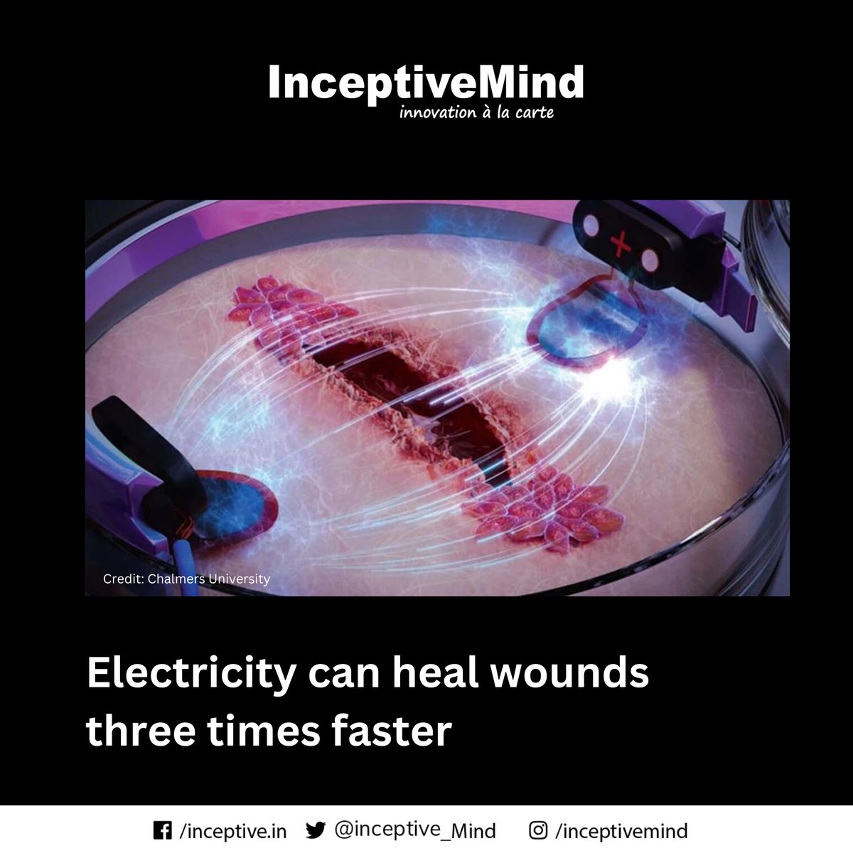 Inceptive_Mind's tweet photo. Chalmers University researchers have developed a method that speeds up the healing process, making wounds heal three times faster.
#research #chalmersuniversity #healingprocess #innovation #invention #newtechnology #inceptivemind https://t.co/2k2jlRwbSu
