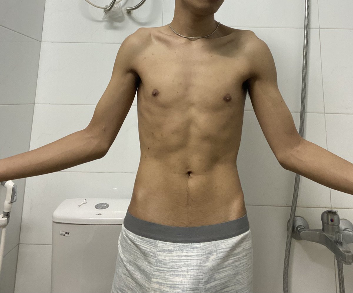 seng87568358's tweet photo. បងគ្មានទេ 6 packs-abs ដូចគេ https://t.co/wsN2COJ0Gz