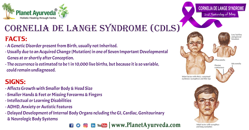 PlanetAyurveda4's tweet photo. Cornelia De Lange Syndrome Awareness Day - 2nd Saturday of May
#CorneliaDeLangeSyndrome #CorneliaDeLangeSyndromeAwarenessDay #CorneliaDeLangeSyndromeAwareness #GeneticDisorders #GeneticDisorder #CDLS #CDLSAwarenessDay #CDLSAwareness #CDLSDisease #CDLSDiseaseAwareness #CDLSDiseaseAwarenessDay #CDLSAwarenessDay #CorneliaDeLangeSyndromeAwarenessDay2023 #13thMay2023 #May13 #DNAAbnormality