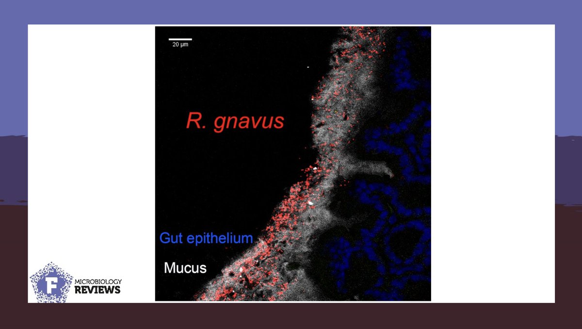 FEMSmicro's tweet photo. A crucial member of the human gut fermenters, #Ruminococcus gnavus is involved in human health and disease. Crost et al. identify and discuss gaps in the knowledge on health associated mechanisms of this versatile bug.  https://t.co/7fVnGvudCd 
#FEMSMicrobiolRev @JugeLab https://t.co/yEMrjjfxRq