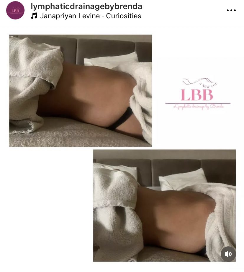 Chukulee_'s tweet photo. Non surgical body sculpting
Detox and weight loss
Manual lymphatic drainage massage
https://t.co/SIK9pLI5GY
#brazillianlymphaticdrainagemassage #lymphaticdrainagemassageinlagos #coloncleanse #detox #weightloss #bodysculpting #bootylift #summer #lagos #vi #curvy https://t.co/vg8nxDhFZK