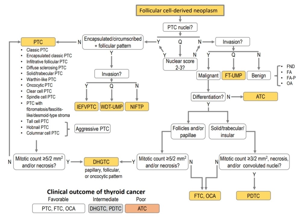 ariabdullah1978's tweet photo. Per new WHO guidelines, this tumour should be upgraded from minimally invasive FC to differentiated high-grade thyroid carcinoma (DHGTC)
Any well differentiated thyroid carcinoma (PTC &amp; FTC) with ⬆️ mitosis equal or more than 5/2 mm² and/or necrosis should be called DHGTC https://t.co/xiMaeicAlh