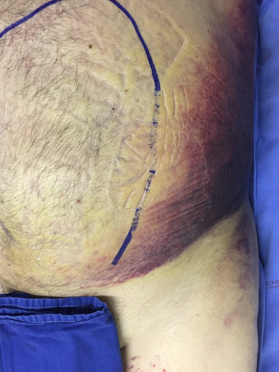 Walter Jr. Boim de Araujo tweet media