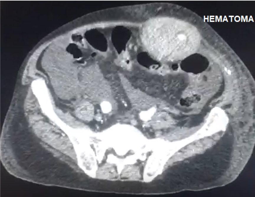 Walter Jr. Boim de Araujo tweet media
