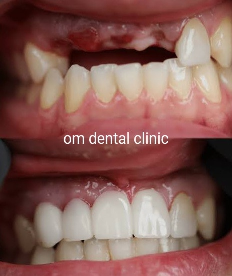 OMDENTALCLINICS's tweet photo. #Best dental clinic near you in sector 21 c farida..For more info visit...https://t.co/kTt5D653Rj https://t.co/2Fy6Qa5vye