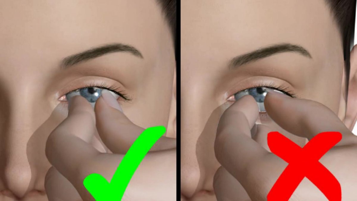 ow.ly/ys2K104G2pL ow.ly/8h2N104G5aj The contact lens magician - aop.org.uk