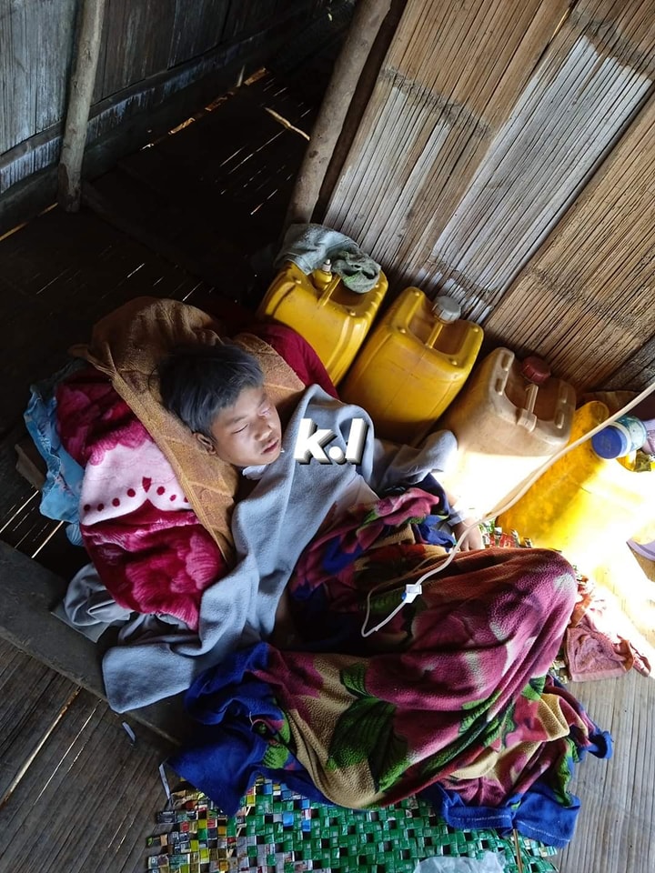 Khithitofficial's tweet photo. ဖယ်ခုံတွင် စစ်တပ်က တိုက်ပွဲဖြစ်ပွားခြင်း မရှိဘဲ ကျေးရွာအတွင်း တိုက်လေယာဥ်ဖြင့် ဗုံးကျဲတိုက���ခိုက်မှု ပြည်သူ ၃ ဦး ပြင်းထန် ဒဏ်ရာရ
Read more->https://t.co/ii1SXEUpz4 https://t.co/MZuDbD86MH