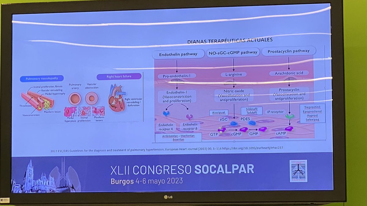 #42CongresoSocalpar 
SER ENFERMERA EN UNA UNIDAD DE HTP: MANEJO Y PARTICULARIDADES DE BOMBAS DE INFUSIÓN DE FÁRMACOS PARA LA HTP. <a href="/Socalpar/">Socalpar</a> <a href="/EnfermeriaSepar/">Enfermería SEPAR</a>