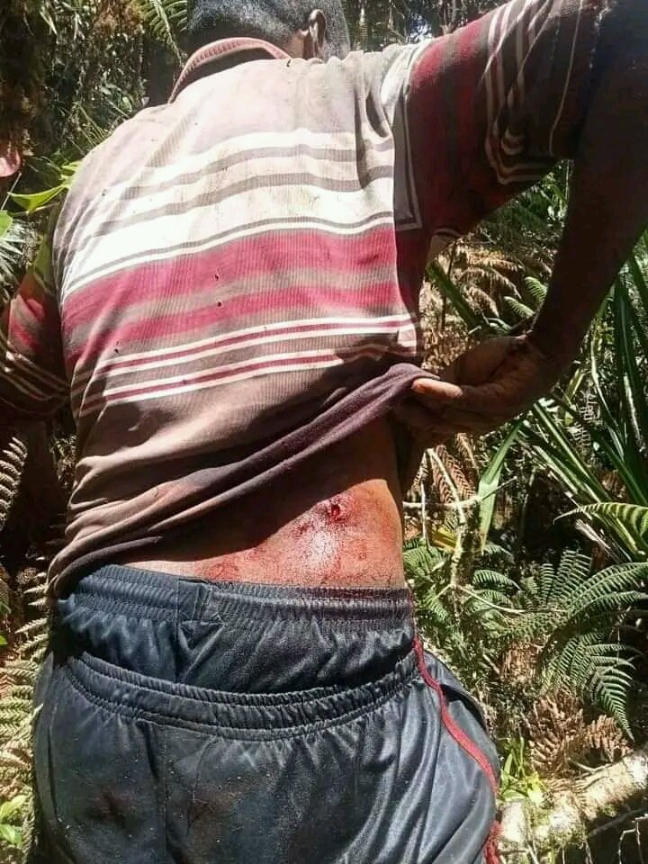Mulalt_'s tweet photo. Update Terkini!

Puncak Papua Darurat Militer!
Warga Sipil, Pdt. Paniur Tabuni, kepala Sekolah SMA YPPGI SINAK. DI tembak kemarin oleh TNI saat sedang ke kebun di distrik Sinak Kabupaten Puncak Papua.  Siang ini akan di evakuasi ke timika untuk menjalani pengobatan!(5/05/2033) https://t.co/jbfVxcCd7I