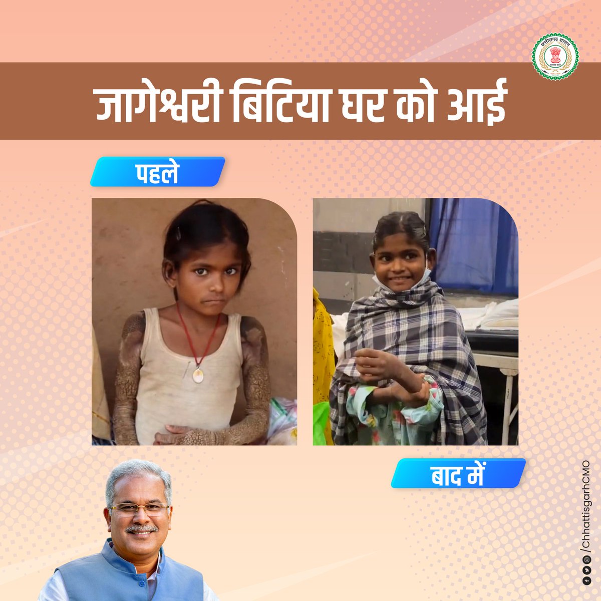 घर लौटकर आई जागेश्वरी 

अपनी जेनेटिक बीमारी की वजह से देशभर में चर्चित जागेश्वरी अतंतः स्वस्थ होकर अपने घर लौट गई है।  दंतेवाड़ा की यह आदिवासी बच्ची दुर्लभ त्वचा रोग से पीड़ित थी और उसका इलाज निरंतर चल रहा था। बालिका के स्वास्थ्य को देखते हुए स्वास्थ्य विभाग की  निगरानी में
