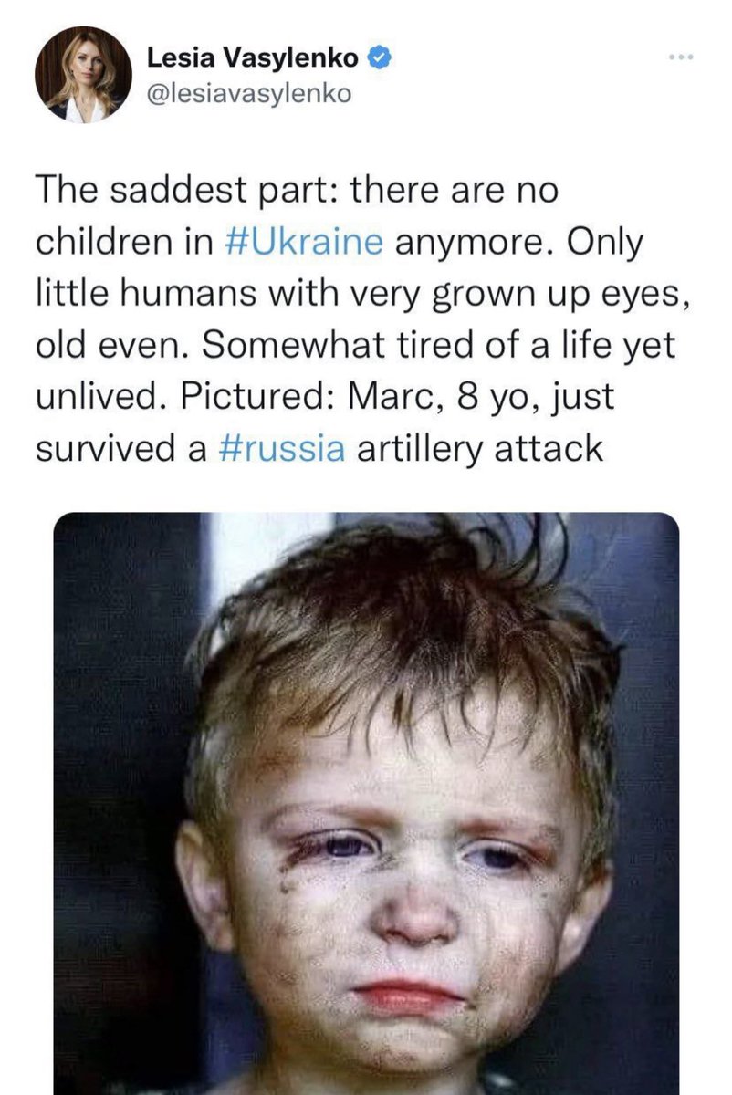 VictoryDay_Hope's tweet photo. Ukrainian MP Lesia Vasylenko shared on Twitter the photo of 8-year-old Marc who had just survived a "Russian artillery attack". This is actually a cover photo taken from a book published in 2013 in Spain 🇪🇸

More bullshit, don’t be fooled. https://t.co/7pXhBcg9Xi