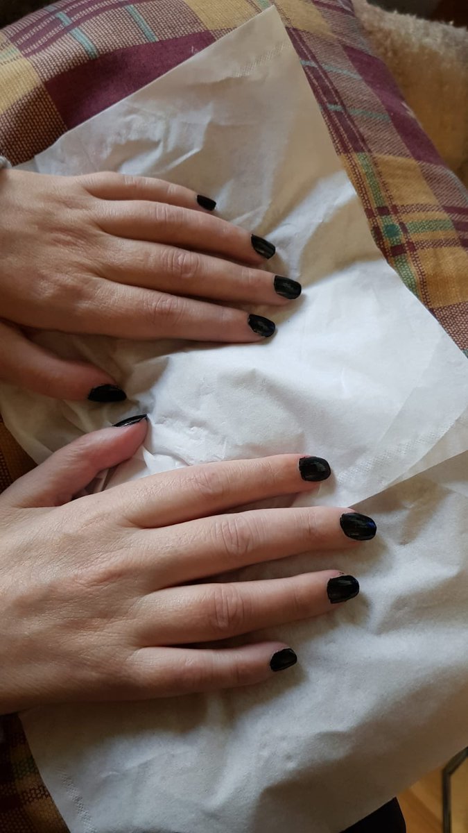 EstunigaRakel's tweet photo. Mirad, esas manos que ahora permanecen inertes en otro momento de la vida eran muy activas, acariciaban el pelo de mi hija, abrazaban a mis seres queridos y amigos, cocinaban, pintaban, cosian, conducían, hacían deporte, bailaban...
Ahora solo pueden aferrarse a la vida https://t.co/Vees5jf0th