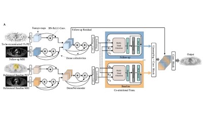 Radiology: Artificial Intelligence (@radiology_ai) on Twitter photo AI Transformers for Radiation Dose Reduction in Serial Whole-Body PET Scans doi.org/10.1148/ryai.2… <a href="/YanranWangJoyce/">Joyce Yan-Ran Wang</a> <a href="/StanfordDeptMed/">Stanford Department of Medicine</a> #Transformers #PedsRad #MachineLearning AI Transformers for Radiation Dose Reduction in Serial Whole-Body PET Scans doi.org/10.1148/ryai.2… <a href="/YanranWangJoyce/">Joyce Yan-Ran Wang</a> <a href="/StanfordDeptMed/">Stanford Department of Medicine</a> #Transformers #PedsRad #MachineLearning