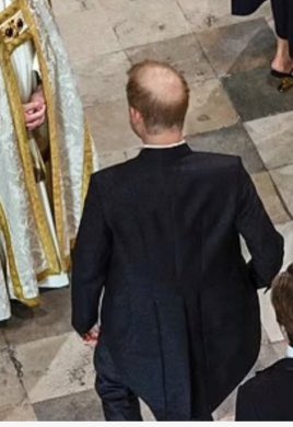 So apparently photos of the top of H’s head are not allowed in CA. So make sure you retweet this lol.