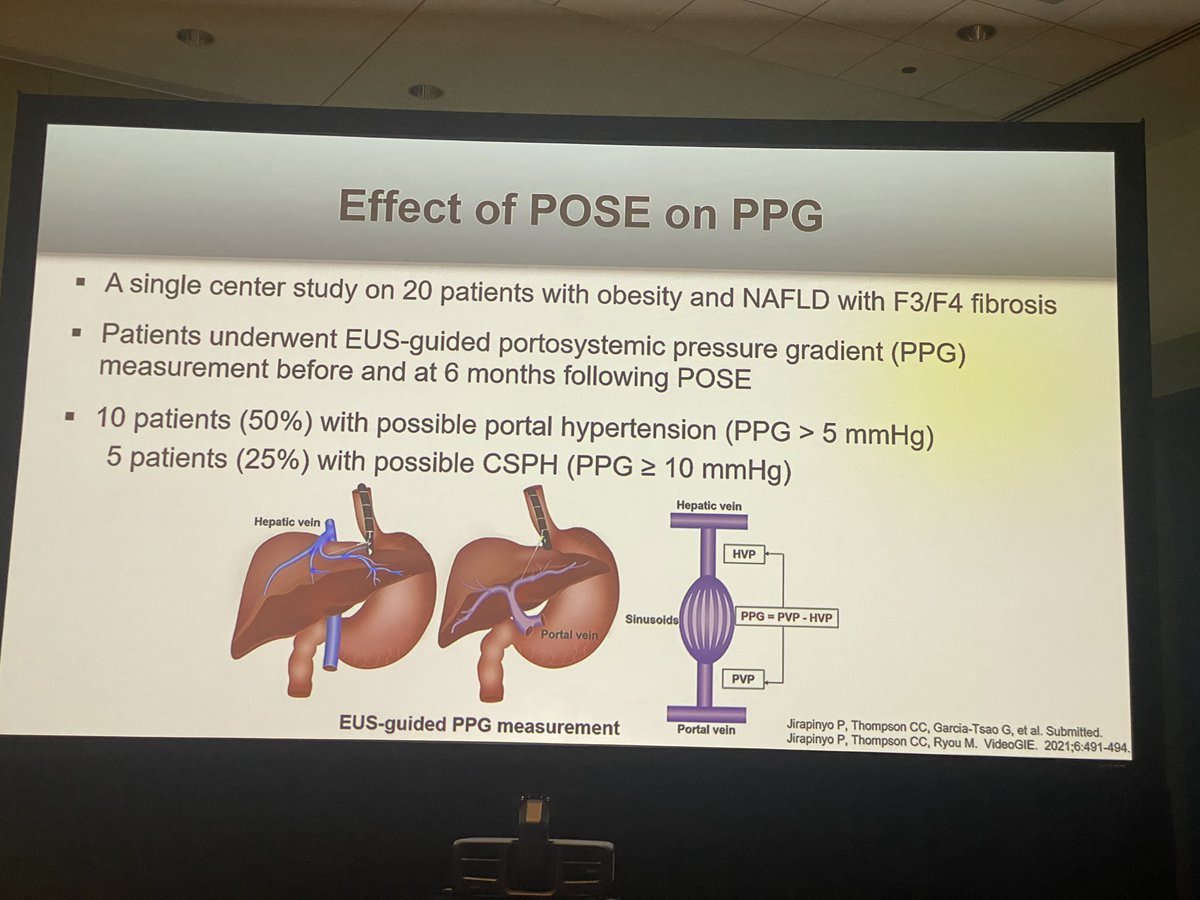 helpatologist's tweet photo. Another fascinating talk showcasing the benefits of POSE for our liver patients by Dr Jirapinyo
#EndoHepatology #EUSPPG #livertwitter #DDW2023 @DDWMeeting https://t.co/NTH96uR5KB