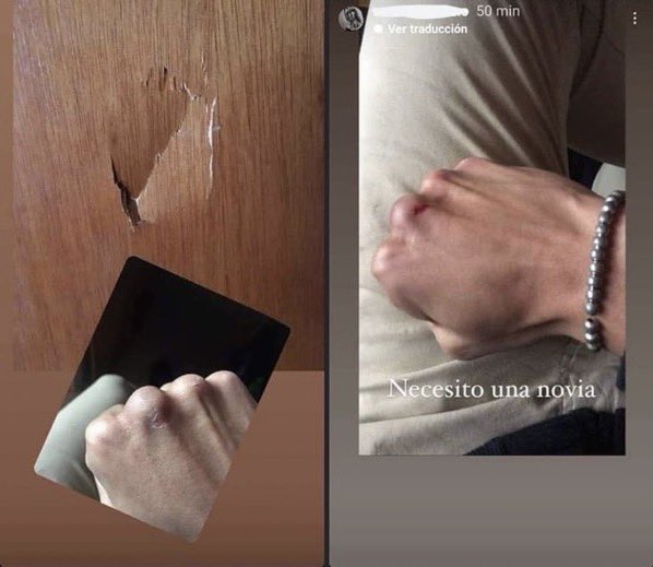 Necesitas un psicólogo no una novia