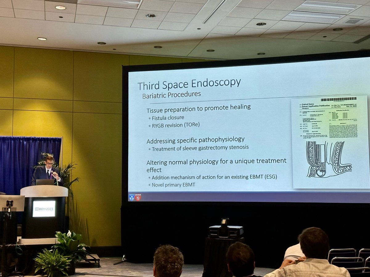 PopovVioleta's tweet image. ⁦@MetabolicEndo⁩ discussing #ThirdSpace #Endoscopy uses in #BariatricEndo. Impressive progress over the years 🆙!
TORe: from 4% weightloss with interrupted suture to 8% #TWL with running to 12% TWL with #ESD-TORe!
⁦@ASGEendoscopy⁩ ⁦@DDWMeeting⁩ #DDW2023