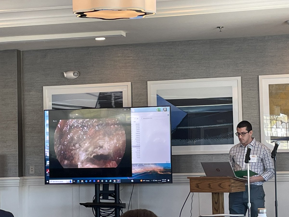 Tess Aulet (@tessaulet) on Twitter photo Louis Shaevel delivering an excellent presentation at NESCRS on using a combined TAMIS and transanal approach for management of large rectal polyp <a href="/UMASSColorectal/">UMASS Colorectal Surgery</a> <a href="/justinmaykel/">Justin Maykel</a> <a href="/KarimAlavi/">Karim Alavi</a> <a href="/PRSturrock/">Paul Sturrock</a> <a href="/jendavidsmd/">Jennifer Davids, MD</a> <a href="/JanetMcD3/">JanetMcDade</a> Louis Shaevel delivering an excellent presentation at NESCRS on using a combined TAMIS and transanal approach for management of large rectal polyp <a href="/UMASSColorectal/">UMASS Colorectal Surgery</a> <a href="/justinmaykel/">Justin Maykel</a> <a href="/KarimAlavi/">Karim Alavi</a> <a href="/PRSturrock/">Paul Sturrock</a> <a href="/jendavidsmd/">Jennifer Davids, MD</a> <a href="/JanetMcD3/">JanetMcDade</a>