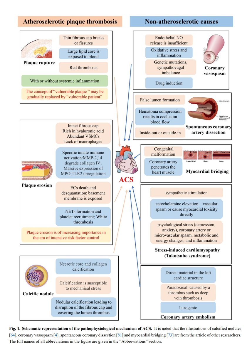 Nuevos Conceptos en la Fisiopatología del Sindrome Coronario Agudo 🫀

📚Reviews in Cardiovascular Medicine

doi.org/10.31083/j.rcm…

Artículo completo 👇🏼✅🆓️
t.me/+USXFpZFtD_AyN…