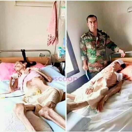 Omar_Madaniah's tweet photo. #لن_ننسى
عندما اخرجوا عصابات بشار الاسد هذا المعتقل من السجون ليتعالج ويبقى على قيد الحياة ويستمروا في تعذيبه
#سوريا https://t.co/QADpfwLGbC