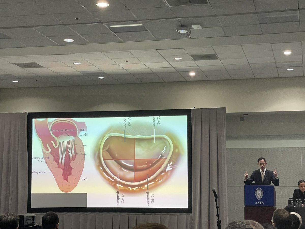 “Do not cross the midline, do not cross the equator” Simple rules for placing neochords by Joseph Woo @StanfordCTSurg in an excellent presentation! #AATS2023 @AATSHQ