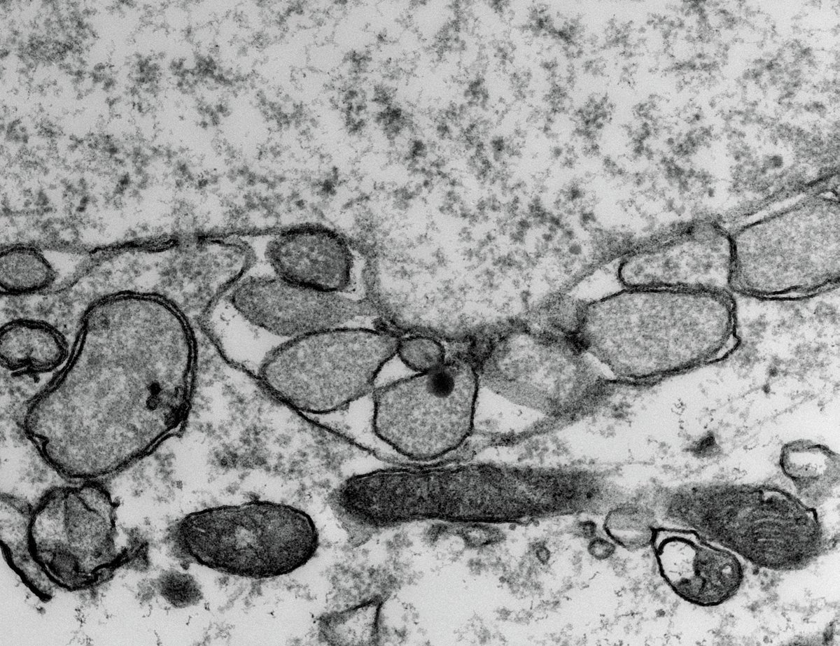 Science Translational Medicine (@sciencetm) on Twitter photo Although most research on #dystonia has tied the condition to disrupted circuits in the brain, new work in mice from <a href="/BrownstoneLab/">Brownstone Lab</a> shows that inherited, early-onset dystonia can develop solely from abnormal neural circuits in the spinal cord. <a href="/UCLIoN/">UCL Queen Square Institute of Neurology</a> scim.ag/2vi Although most research on #dystonia has tied the condition to disrupted circuits in the brain, new work in mice from <a href="/BrownstoneLab/">Brownstone Lab</a> shows that inherited, early-onset dystonia can develop solely from abnormal neural circuits in the spinal cord. <a href="/UCLIoN/">UCL Queen Square Institute of Neurology</a> scim.ag/2vi
