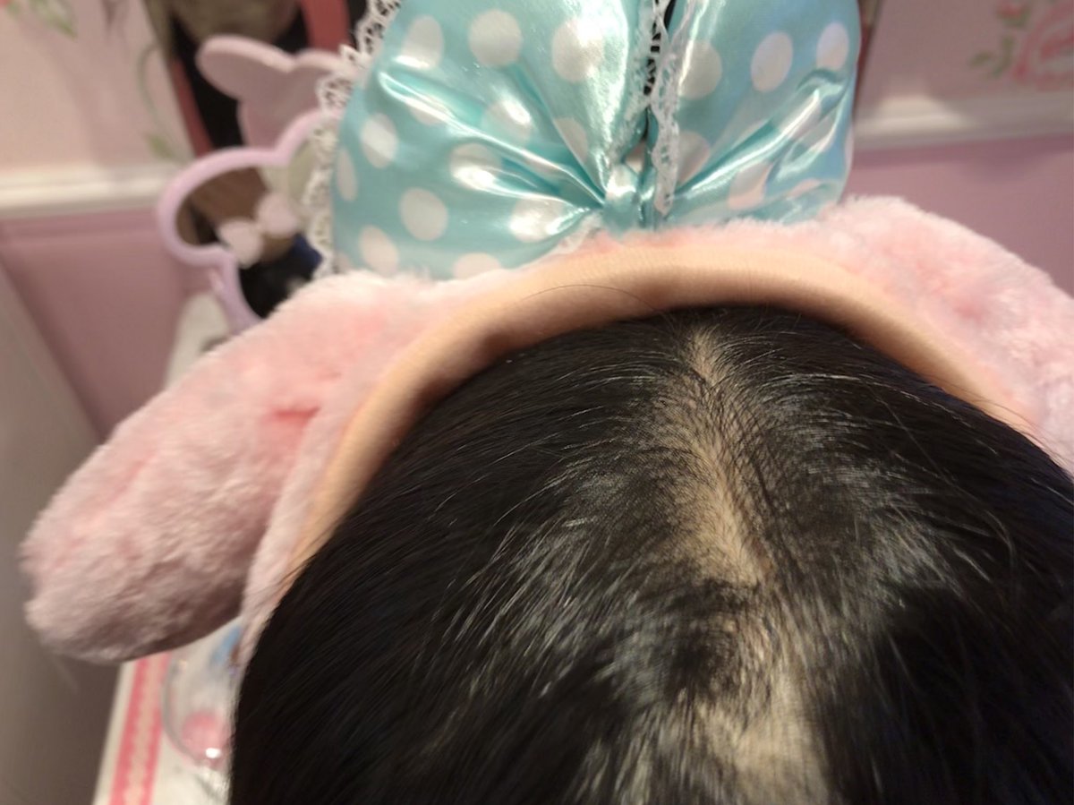 bg_pelz's tweet photo. 雨ぇ☔️☔️☔️

が、いい事が😄以前から  仲良しの
元 メイドさんと 四年ちょいぶりに
サンリオ����行くことに🤗🤗🤗

まだ 先だけど、楽しみ🤗

連絡くれて、ありがとう😊

大人っぽくなった😳らしいけど、
僕は、髪の毛の過疎化進んでます😭😭😭

又 これ食べて来ます🤗
大阪  恋物語🤗🤗🤗 https://t.co/u65jQ60NfC