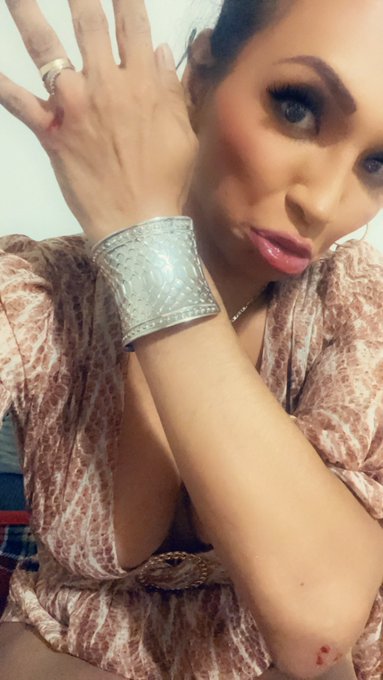 Sooooo this happened  It hurts soooo bad https://t.co/jvNItinGnF<a href="/tag/transexual"class="tags"><span>#transexual</span></a><a href="/tag/pornstar"class="tags"><span>#pornstar</span></a><a href="/tag/girlslikeus"class="tags"><span>#girlslikeus</span></a><a href="/tag/jessydubai"class="tags"><span>#jessydubai</span></a>