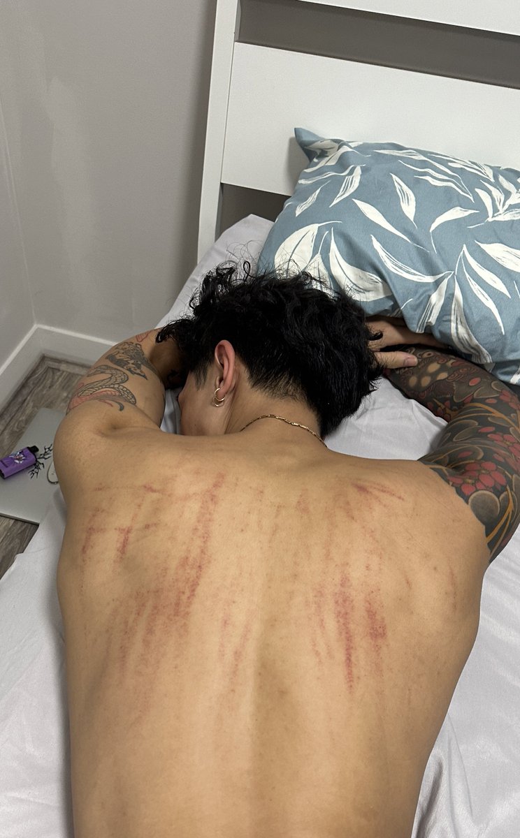 slayrsai's tweet photo. Rough night. https://t.co/zDI0olB6a6