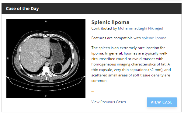 drmtniknejad's tweet photo. My Case of the Day on #Radiopaedia
An extremely rare location for the most common soft tissue tumour.
You have never seen a #splenic #lipoma!!
See the full case: https://t.co/aTiGsiD4k9 https://t.co/QUihylPY9h