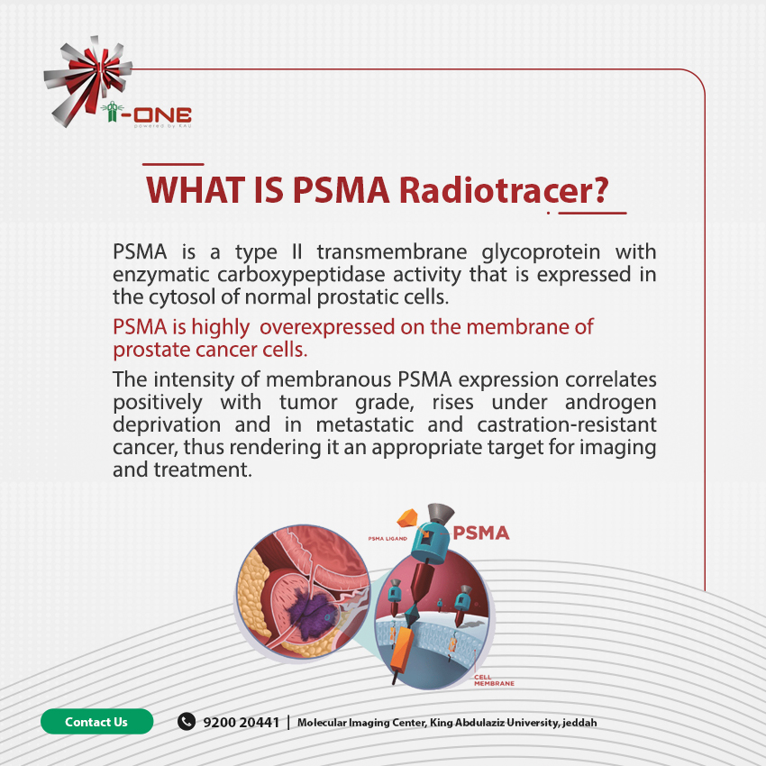 18F-PSMA is now available <a href="/I_ONE_center/">I-ONE</a>