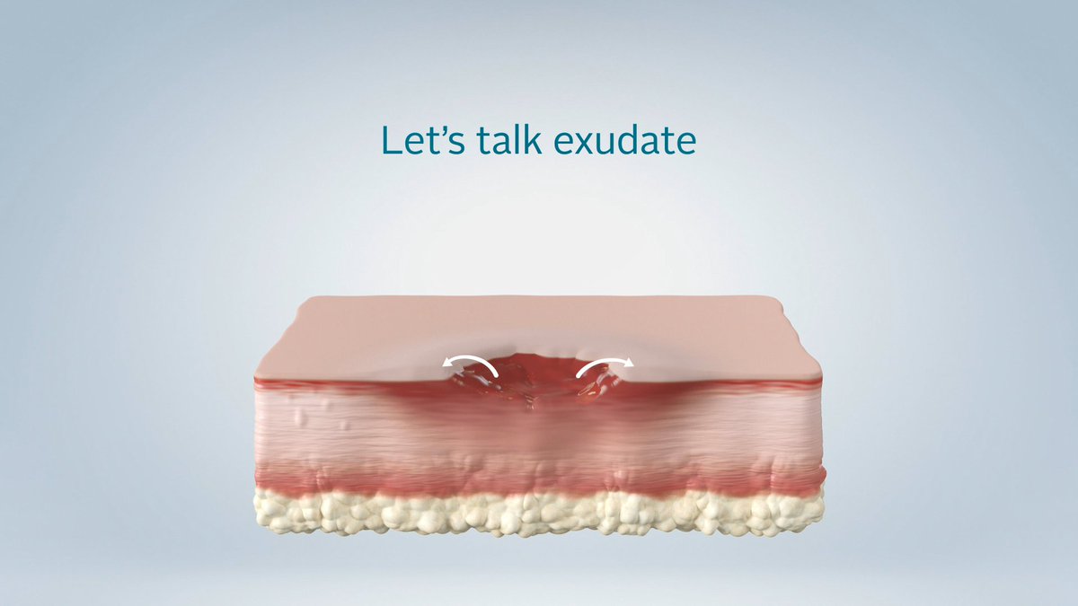 ConvaTecWoundUK's tweet photo. ConvaMax™ Superabsorber is a dressing designed to manage moderate to high levels of fluid and exudate. 
The superabsorbent central pad absorbs exudate and forms a gel, locking it away in the core, preventing release back to the wound. 
See more here: https://t.co/KpDMUUR7SG https://t.co/1zOAF38xmE