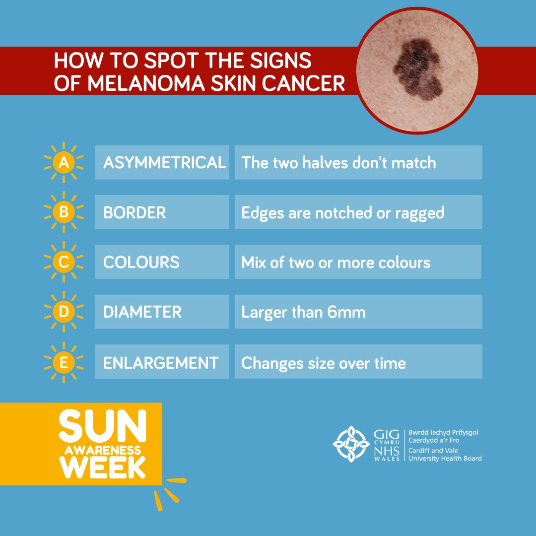 CV_UHB's tweet image. Melanoma skin cancer is the 5th most common cancer in the UK.☀️Exposure to UV light from the sun is thought to cause most melanomas.

Get to know the signs and see your GP if you notice any change to your moles.

Learn more: orlo.uk/Dcmt3

#SunAwarenessWeek #SunSafety