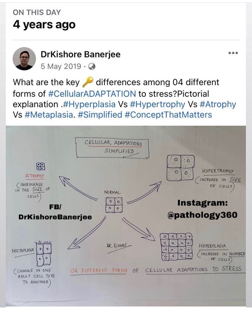 IG_pathology360's tweet photo. 4-Key-Types of : Cellular Adaptation. Basics revisited. 4-years-ago. #pathology360 #DrKishoreBanerjee #medicine #MedStudentTwitter https://t.co/bBXvlQRAF5