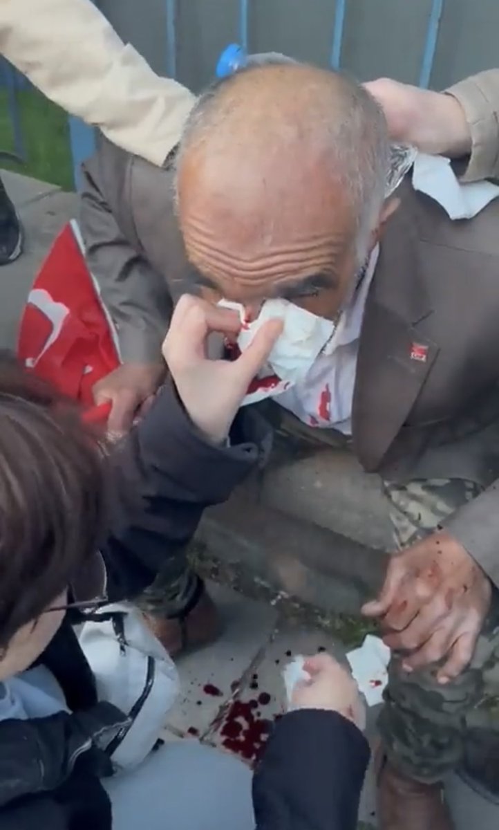 Yaralanan vatandaşlardan.