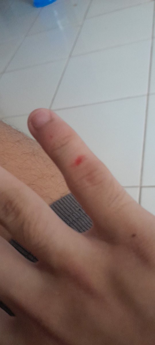 lliunck's tweet photo. fui tentar brincar de dj com q dona emilly e ela arrancou um chaboco do meu dedo((era so dizer um nao https://t.co/29Zoo6tc0g