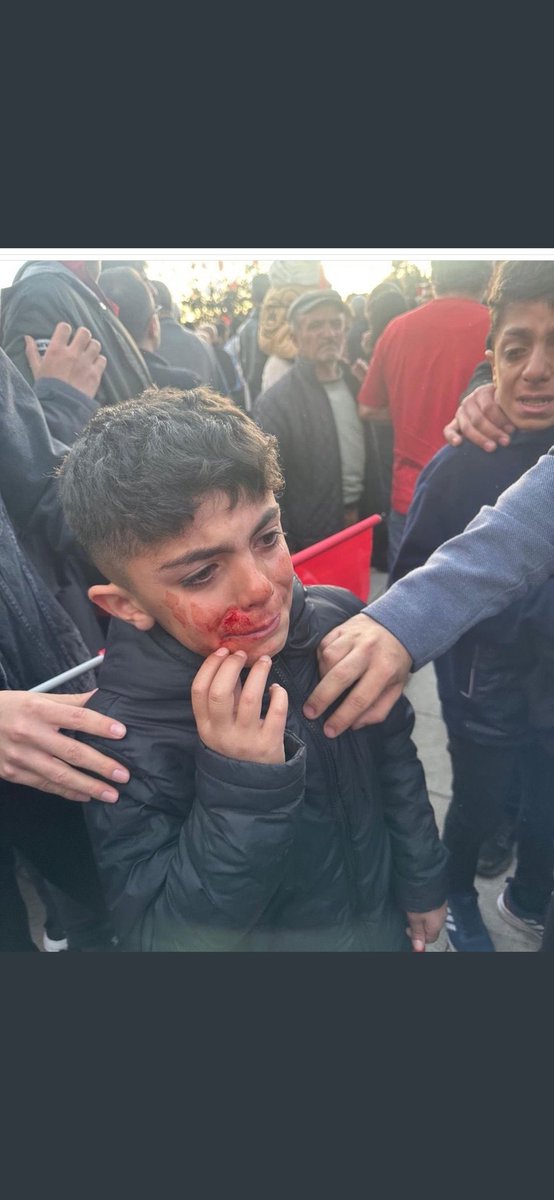 Erzurum'daki Mitinge güvenlik önlemini Bilerek Almadığınız İçin bu çocuğun Vebali Senin Üstüne Erzurum Valisi #okayMemiş