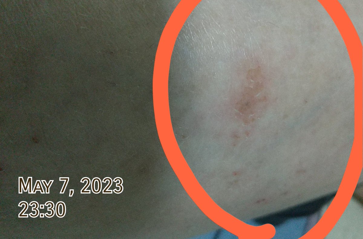 NozomiN9999's tweet image. 昨夜からチクチクチクチク執着を疎ましく思っていたら成果を残していきやがった奇行カルト宗教バエ。

サイバーナイフの要領で遠隔から攻撃するオモチャが島で野放しな理由。

#集団ストーカー 
#ElectromagneticWave

大谷翔平share