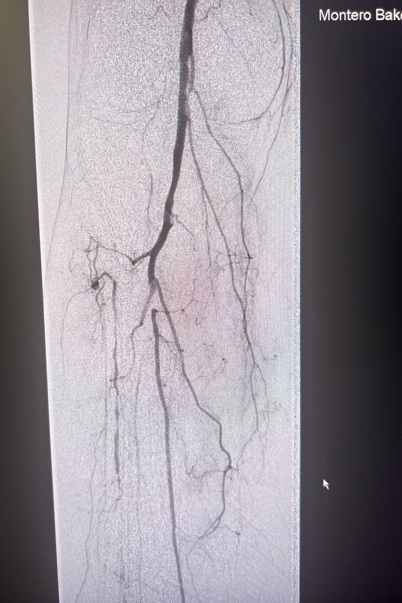 ᗰIGᑌEᒪ ᗰOᑎTEᖇO-ᗷᗩKEᖇ tweet media