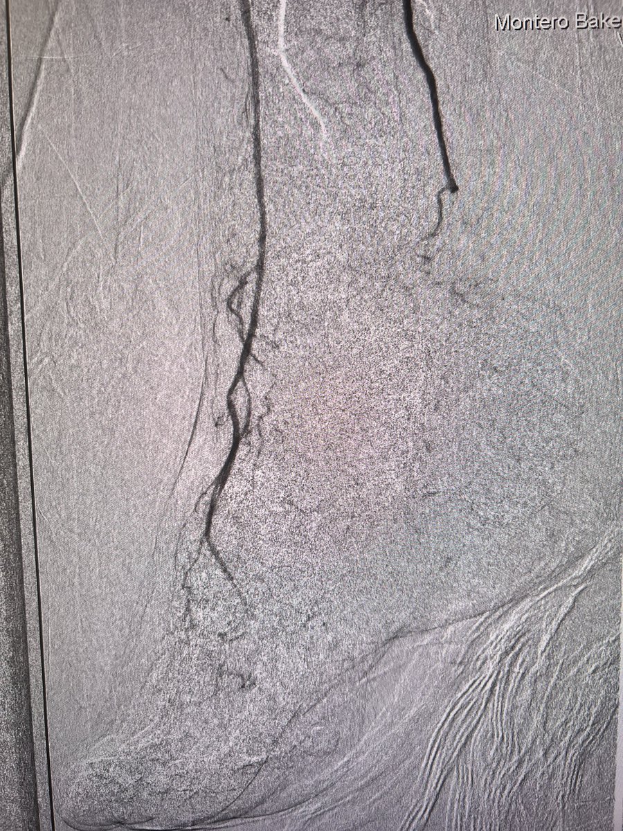 ᗰIGᑌEᒪ ᗰOᑎTEᖇO-ᗷᗩKEᖇ tweet media