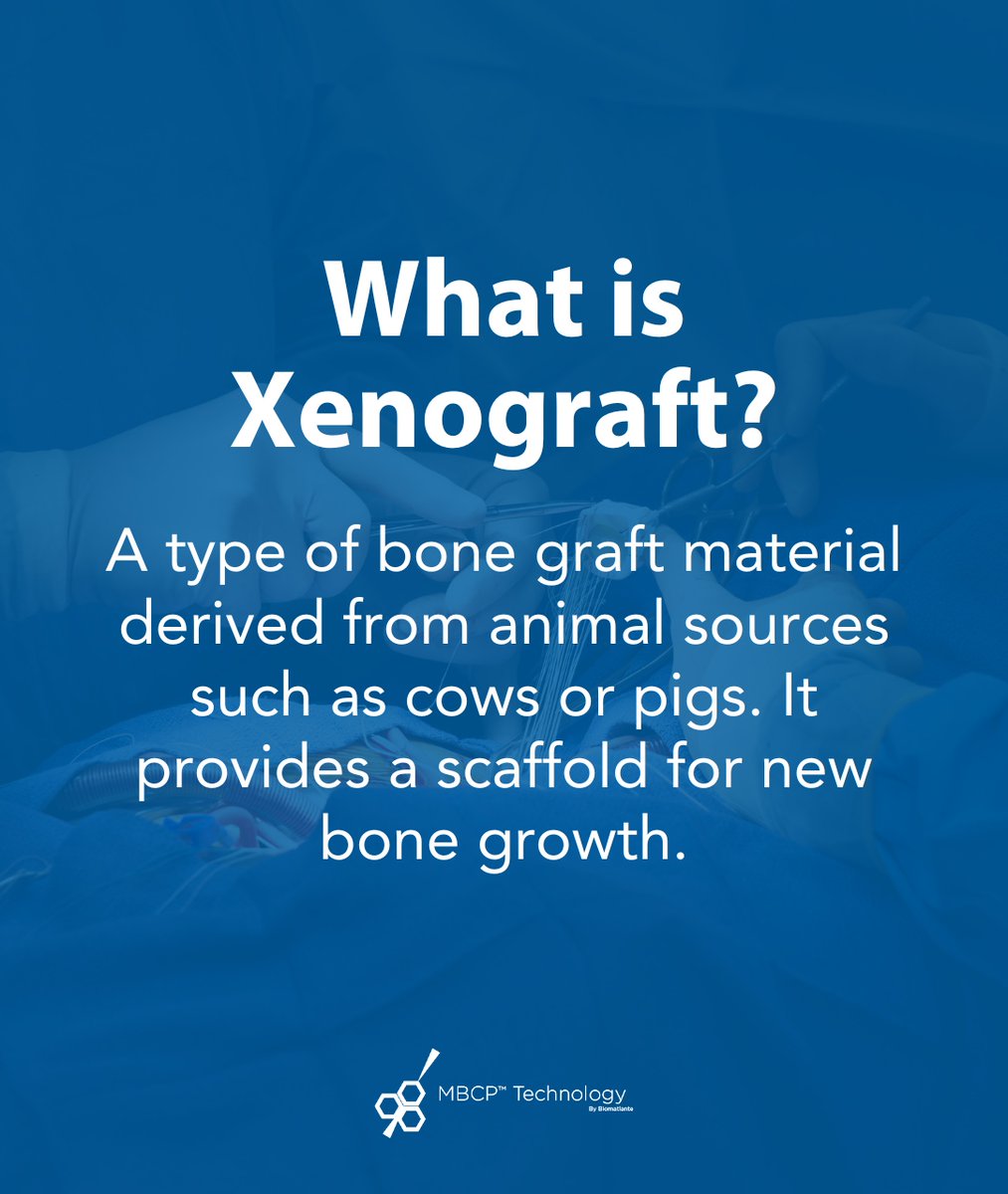 Xenograft is a material commonly used in #orthopedic and #dentalsurgeries. It is derived from animal sources, usually cows or pigs, and undergoes extensive processing to remove all cellular and organic components while retaining the mineral structure of the bone. #bonegraft